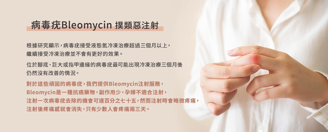 根據研究顯示，病毒疣接受液態氮冷凍治療超過三個月以上，
                        繼續接受冷凍治療並不會有更好的效果。
                        位於腳底、巨大或指甲邊緣的病毒疣最可能出現冷凍治療三個月後仍然沒有改善的情況。
                        對於這些頑固的病毒疣，我們提供Bleomycin注射服務，
                        Bleomycin是一種抗癌藥物，副作用少，孕婦不適合注射，
                        注射一次病毒疣去除的機會可達百分之七十五，然而注射時會略微疼痛，
                        注射後疼痛感就會消失，只有少數人會疼痛兩三天。